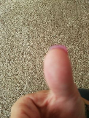 Right thumb nail longer than the left.