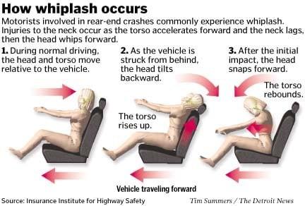 Whiplash/Acc. Dec.