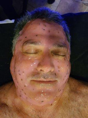 Hubby with soothing hydrojelly mask, post-chemical peel.