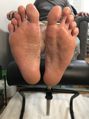 My hubby's feet after, all nice and clean....and crust free!