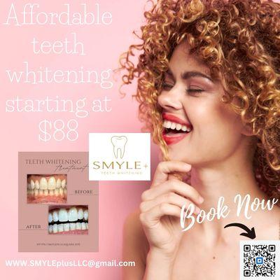 Affordable teeth whitening starting at $88