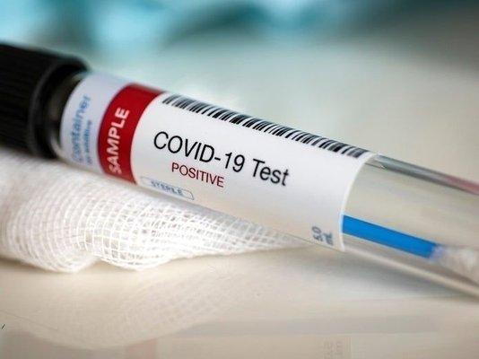 PCR,Antigen and Antibody Covid test available