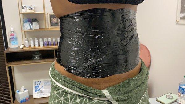 Body contouring-Stomach wrapping