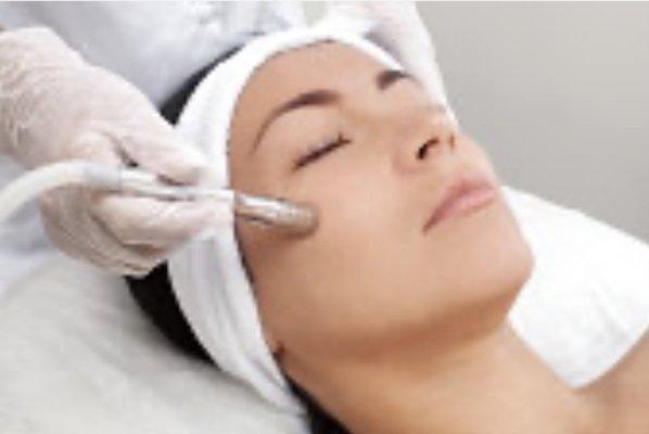 Microdermabrasion