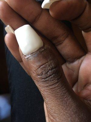 Super glue all around the nail on my finger