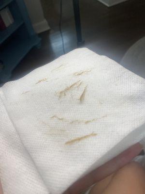 Dead skin and vellus hair from a Dermaplane facial