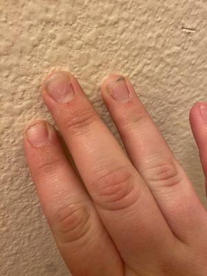 You can see the red spots on my nails which are nicks and cuts from the nail drill.