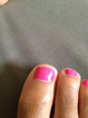 Chipped toe...