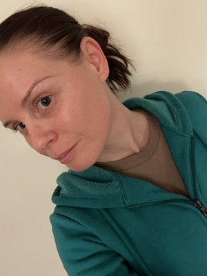 This was my bare skin a couple days after treatment. She always makes sure it is hydrated and glowing!