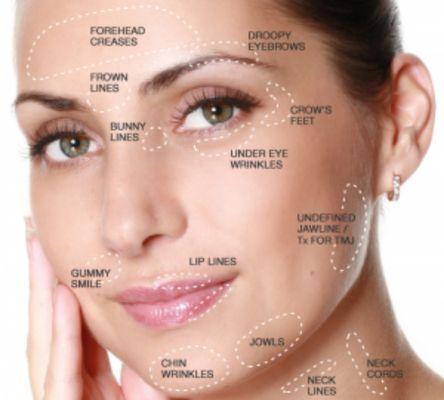 Reduce fine lines, brow lift, and tighter skin with Botox