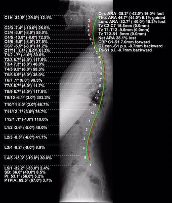 STRUCTURE and posture correction. Correcting the skeletal system is the BLUE PRINT to improving your sport goals.