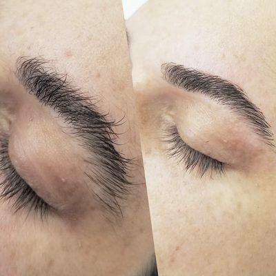 Brow clean up