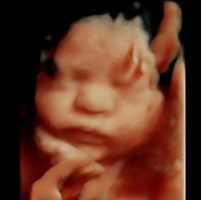 Bows-R-Bowties: 1st Peek 3D/4D Ultrasound