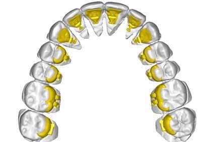 Dental Lab Broward County