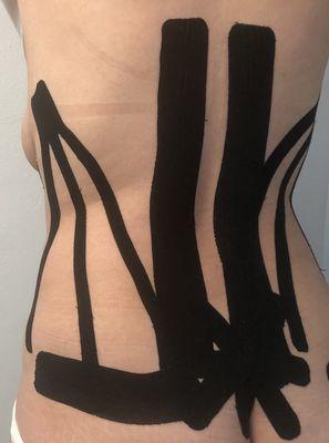 Kinesio Tape