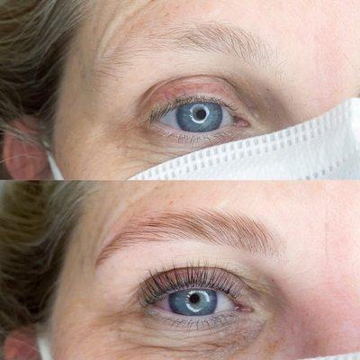 before and after for lash lift and brow lift