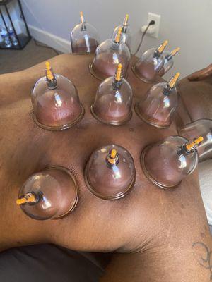 Cupping Therapy session at The Kulture Spa in Wake Forest, NC.