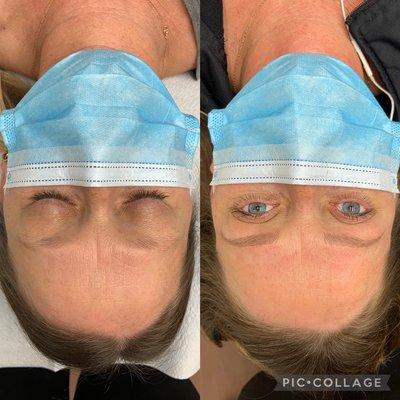 Microblading