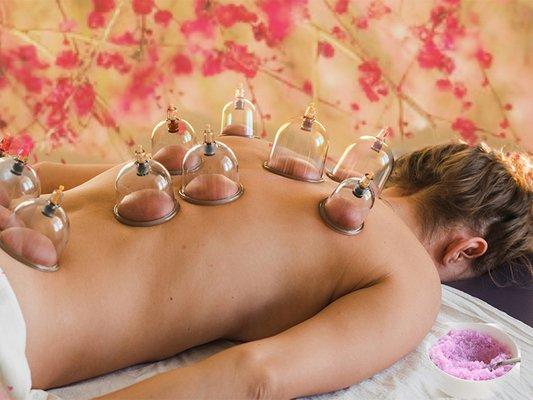 Cupping Therapy