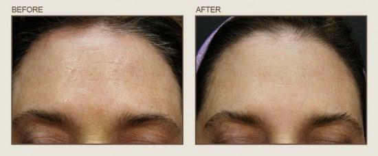 Before & After

Center for Eye & Laser Surgery- Severna Park, Maryland