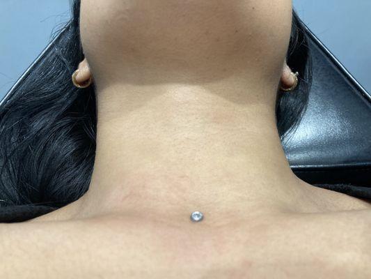 Dermal piercing done with only the best titanium jewlery!