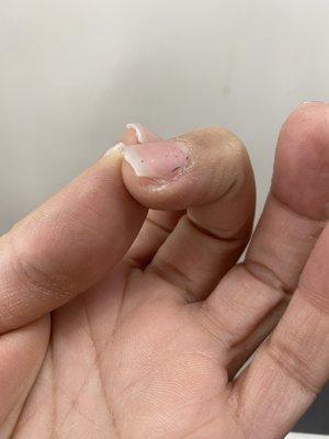 The side of my nail filed way down to the point of painful