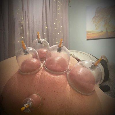 Pain relieving cupping massage