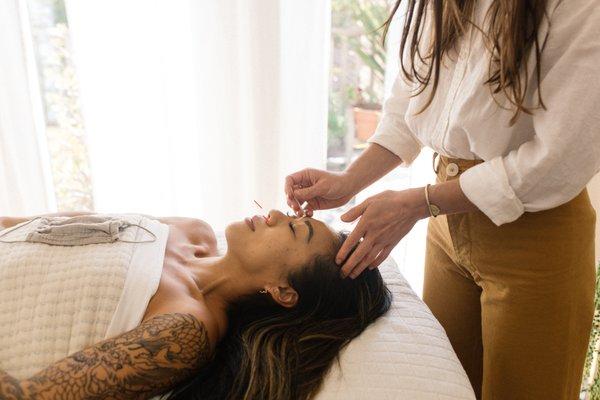 The Garden Acupuncture Facial