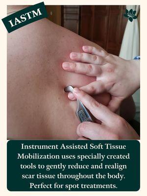 Ashley is now offering Graston technique to help you reduce the effects of scar tissue.