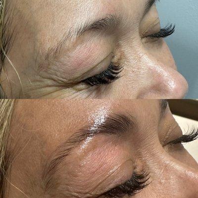 Before and after brow lamination