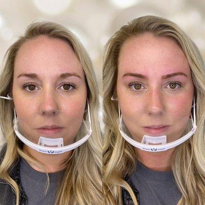 Her whole face change and I'm loving the results of this Microblade and shade transformation!