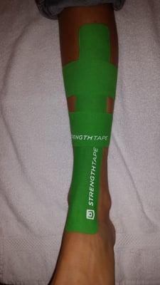 Kinesio Taping Technique used for shin splints