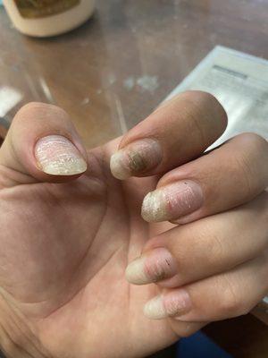 This place destroyed my nails and now I have fungus!