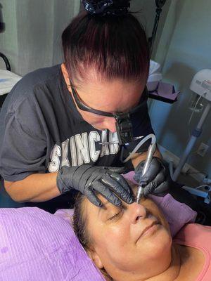 Microdermabrasion facial