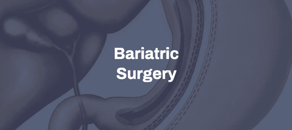 Bariatric Surgery
or Weight Loss Surgery