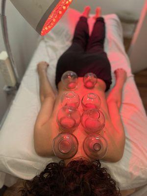 Cupping for relaxation and increased circulation