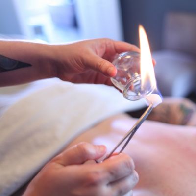 Fire Cupping