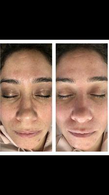 Come get instant results just like this beauty!