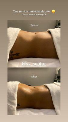 Before & After one session of lymphatic sculpting massage with Maritza!!!