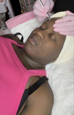 Customized Microdermabrasion Facial