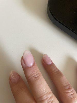 Crooked shape and dirt underneath since the natural nail was peeling.