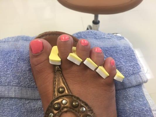 Ugly pedicure