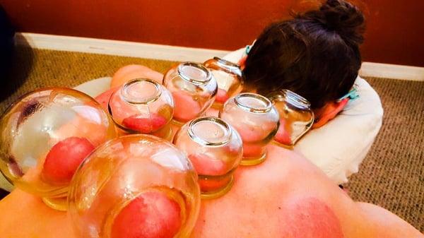 Fire cupping for deeper bodywork; also enhances lymph flow, circulation and reduction of adhesive scar tissue.