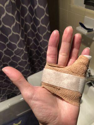 Bandaged Hand via Minute Clinic