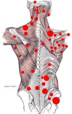 Dealing with neck and back pain? OWS can assist you with relieving and stretching your muscles.