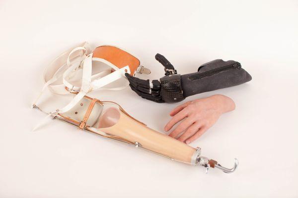 Winkley Upper Limb Prostheses