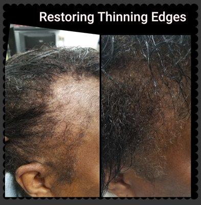 Restoring Thinning Edges