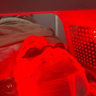 Red LED Treatment