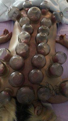 Cupping