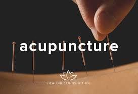 Acupuncture!